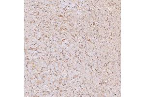IHC analysis of SGCE using anti-SGCE antibody (ABIN7601544). (SGCE antibody  (AA 38-407))
