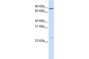 Western Blotting (WB) image for anti-G-Protein Signaling Modulator 2 (GPSM2) (N-Term) antibody (ABIN2784504)