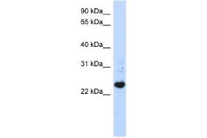 C21ORF56 antibody used at 1 ug/ml to detect target protein. (C21ORF56 antibody)