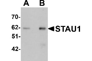 Western Blotting (WB) image for anti-Staufen Double-Stranded RNA Binding Protein 1 (STAU1) (C-Term) antibody (ABIN1030702) (STAU1/Staufen antibody  (C-Term))