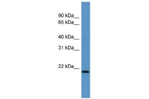 WB Suggested Anti-Arpc4 Antibody Titration:  0. (ARPC4 antibody  (N-Term))