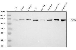 Western blot analysis of SF3A1 using anti-SF3A1 antibody (ABIN7600556). (SF3A1 antibody  (AA 20-556))