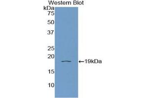 Western blot analysis of recombinant Human IL11Ra. (IL11RA antibody  (AA 59-220))