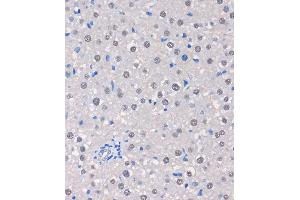 Immunohistochemistry of paraffin-embedded Rat liver using MTMR8 Rabbit pAb (ABIN7268766) at dilution of 1:100 (40x lens). (MTMR8 antibody  (AA 430-560))