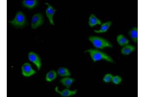 Immunofluorescence staining of A549 cells with ABIN7160322 at 1:133, counter-stained with DAPI. (ABCC6 antibody  (AA 730-931))