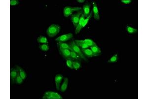 Immunofluorescence staining of HepG2 cells with ABIN7166863 at 1:100, counter-stained with DAPI. (PYGO2 antibody  (AA 175-325))