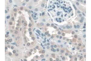 Detection of KATNA1 in Mouse Kidney Tissue using Polyclonal Antibody to Katanin P60 Subunit A 1 (KATNA1) (KATNA1 antibody  (AA 260-491))