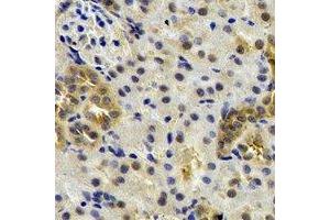 Immunohistochemical analysis of ST3GAL4 staining in rat kidney formalin fixed paraffin embedded tissue section. (ST3GAL4 antibody)