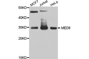 Western blot analysis of extracts of various cell lines, using MED6 antibody (ABIN5974801) at 1/1000 dilution.