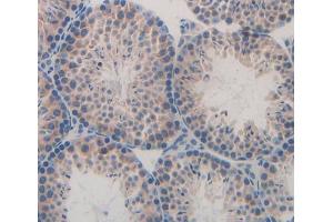 Used in DAB staining on fromalin fixed paraffin- embedded Kidney tissue (GNG8 antibody  (AA 1-70))