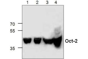 Western Blot analysis of Oct-2 expression in Lysates from Jukat cells (Lanes 1+2), 3T3 cells (Lane 3) and Rat Kidney (Lane 4). (Oct-2 antibody  (C-Term))