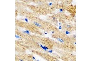 Immunohistochemical analysis of L2HGDH staining in mouse heart formalin fixed paraffin embedded tissue section. (L2HGDH antibody)