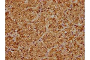 IHC image of ABIN7170757 diluted at 1:100 and staining in paraffin-embedded human adrenal gland tissue performed on a Leica BondTM system. (CYP21A2 antibody  (AA 312-418))