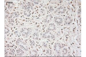 Immunohistochemical staining of paraffin-embedded breast tissue using anti-VEGF mouse monoclonal antibody. (VEGF antibody  (AA 27-233))
