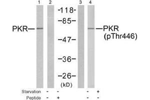 Image no. 2 for anti-Eukaryotic Translation Initiation Factor 2-alpha Kinase 2 (EIF2AK2) (pThr446) antibody (ABIN197048) (EIF2AK2 antibody  (pThr446))