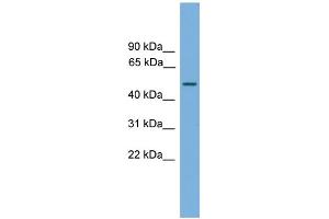 WB Suggested Anti-CPA6 Antibody Titration: 0. (CPA6 antibody  (Middle Region))