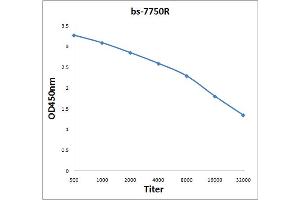 Antigen: 0. (KIF20A antibody  (AA 353-450))