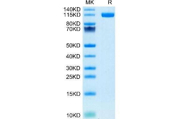 ENPP1 Protein (AA 98-925) (His tag)
