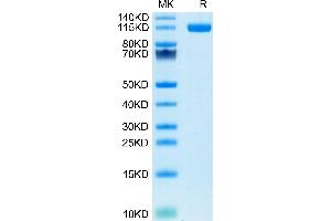 Human ENPP-1 on Tris-Bis PAGE under reduced condition. (ENPP1 Protein (AA 98-925) (His tag))