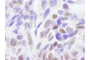 Immunohistochemistry (IHC) image for anti-CREB Binding Protein (CREBBP) (AA 2375-2425) antibody (ABIN7448459) (CBP antibody  (AA 2375-2425))