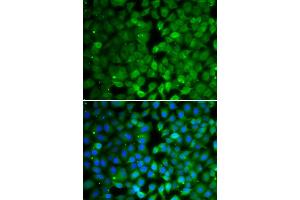 Immunofluorescence analysis of MCF-7 cells using RUNX3 antibody (ABIN4905075). (RUNX3 antibody)
