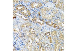 Immunohistochemistry of paraffin-embedded mouse kidney using R Rabbit mAb (ABIN7269840) at dilution of 1:100 (40x lens). (RALBP1 antibody)