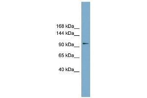 FTSJD1 antibody used at 1 ug/ml to detect target protein. (CMTR2 antibody  (Middle Region))