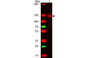 Western Blotting (WB) image for anti-COL1A2/COL1A1 antibody (ABIN5596819)