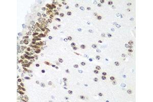 Immunohistochemistry of paraffin-embedded Mouse brain using UBE2U Polyclonal Antibody at dilution of 1:100 (40x lens). (UBE2U antibody)