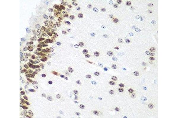 UBE2U antibody