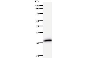 Western Blotting (WB) image for anti-N(alpha)-Acetyltransferase 38, NatC Auxiliary Subunit (NAA38) antibody (ABIN931019) (NAA38 antibody)