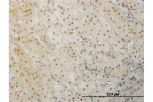Image no. 3 for anti-LIM Homeobox 1 (LHX1) (AA 1-101) antibody (ABIN598782) (LHX1 antibody  (AA 1-101))