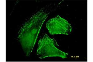 Immunofluorescence of monoclonal antibody to IQGAP1 on HeLa cell. (IQGAP1 antibody  (AA 611-710))