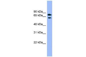 WB Suggested Anti-PANK4 Antibody Titration: 0. (PANK4 antibody  (Middle Region))