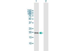 Western Blot analysis of SSH2 expression in transfected 293T cell line by SSH2 MaxPab polyclonal antibody. (SSH2 antibody  (AA 1-178))