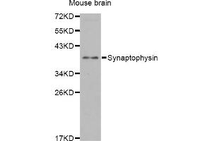 Western blot analysis of extracts of mouse brain, using SYP antibody. (Synaptophysin antibody)