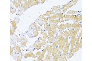 Immunohistochemistry of paraffin-embedded Rat heart using NAT2 Polyclonal Antibody at dilution of 1:100 (40x lens). (NAT2 antibody)