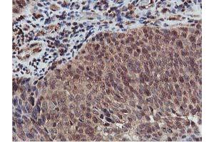 Image no. 2 for anti-V-Akt Murine Thymoma Viral Oncogene Homolog 1 (AKT1) antibody (ABIN1496556) (AKT1 antibody)