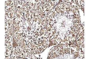 IHC-P Image DYNC1I2 antibody detects DYNC1I2 protein at cytosol on mouse testis by immunohistochemical analysis. (DYNC1I2 antibody)