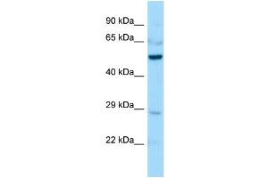 Host:  Rabbit  Target Name:  Creld1  Sample Type:  Mouse Lung lysates  Antibody Dilution:  1. (CRELD1 antibody  (Middle Region))