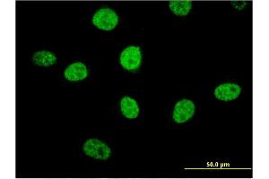 Immunofluorescence of monoclonal antibody to MIPOL1 on HeLa cell. (MIPOL1 antibody  (AA 321-423))