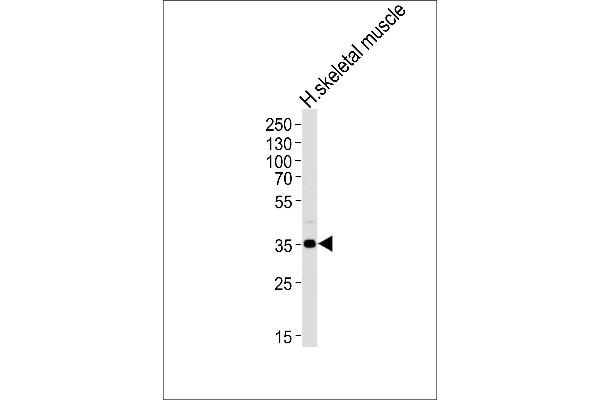 PPP1R3B Antikörper  (C-Term)