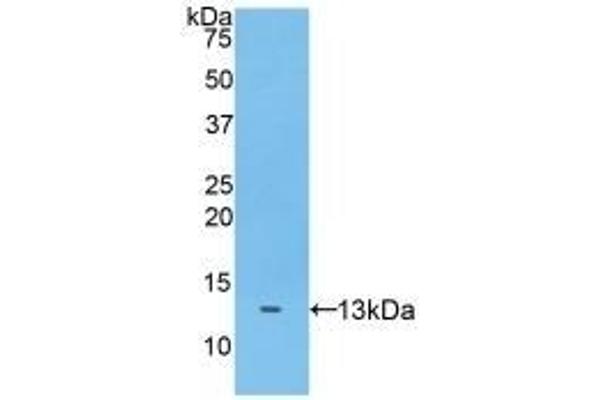 ADAMTS7 antibody  (AA 1589-1686)