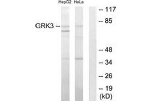 Western Blotting (WB) image for anti-Adrenergic, Beta, Receptor Kinase 2 (ADRBK2) (AA 361-410) antibody (ABIN2889462) (ADRBK2 antibody  (AA 361-410))