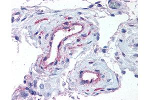 Anti-ADAMTS1 antibody IHC of human testis, vessels. (ADAMTS1 antibody  (N-Term))