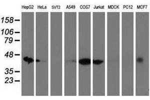 Image no. 2 for anti-DnaJ (Hsp40) Homolog, Subfamily A, Member 2 (DNAJA2) antibody (ABIN1497865) (DNAJA2 antibody)