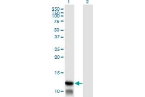 Western Blot analysis of TIMM8A expression in transfected 293T cell line by TIMM8A monoclonal antibody (M01), clone 2F11. (TIMM8A/DDP antibody  (AA 9-97))
