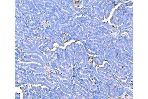anti-Prothrombin Fragment 2 (AA 97-124) antibody