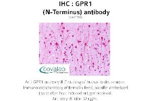 Image no. 2 for anti-G Protein-Coupled Receptor 1 (GPR1) (Extracellular Domain), (N-Term) antibody (ABIN1734890) (G Protein-Coupled Receptor 1 antibody  (Extracellular Domain, N-Term))