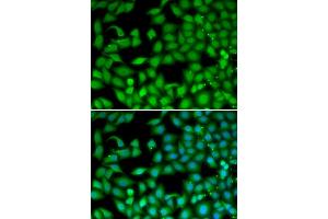 Immunofluorescence analysis of MCF-7 cells using RTKN antibody. (Rhotekin antibody)
